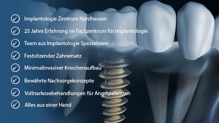 Implantologie für Bad Karlshafen
